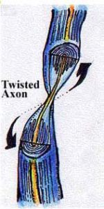 Twisted Axon image